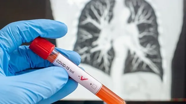 Covid-19: Mais 5 Casos positivos no concelho de Santarém nas últimas 24 Horas