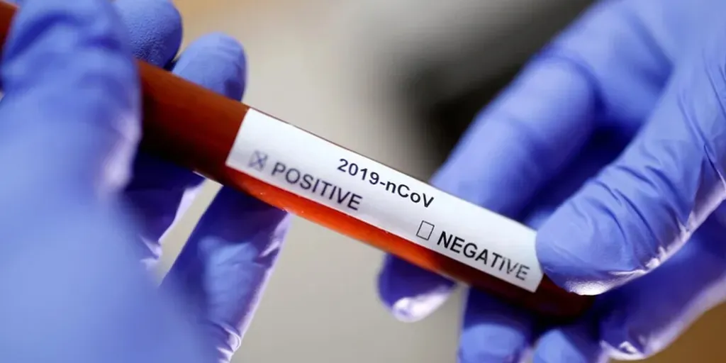 Covid-19: Santa Casa de Alcanede resultados de todos os testes só serão conhecidos esta terça-feira